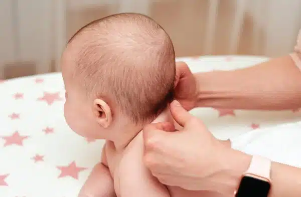 Innovative Approaches to treating Pediatric Torticollis