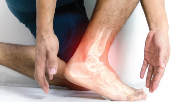 BFR Training for Ankle Sprain Rehabilitation