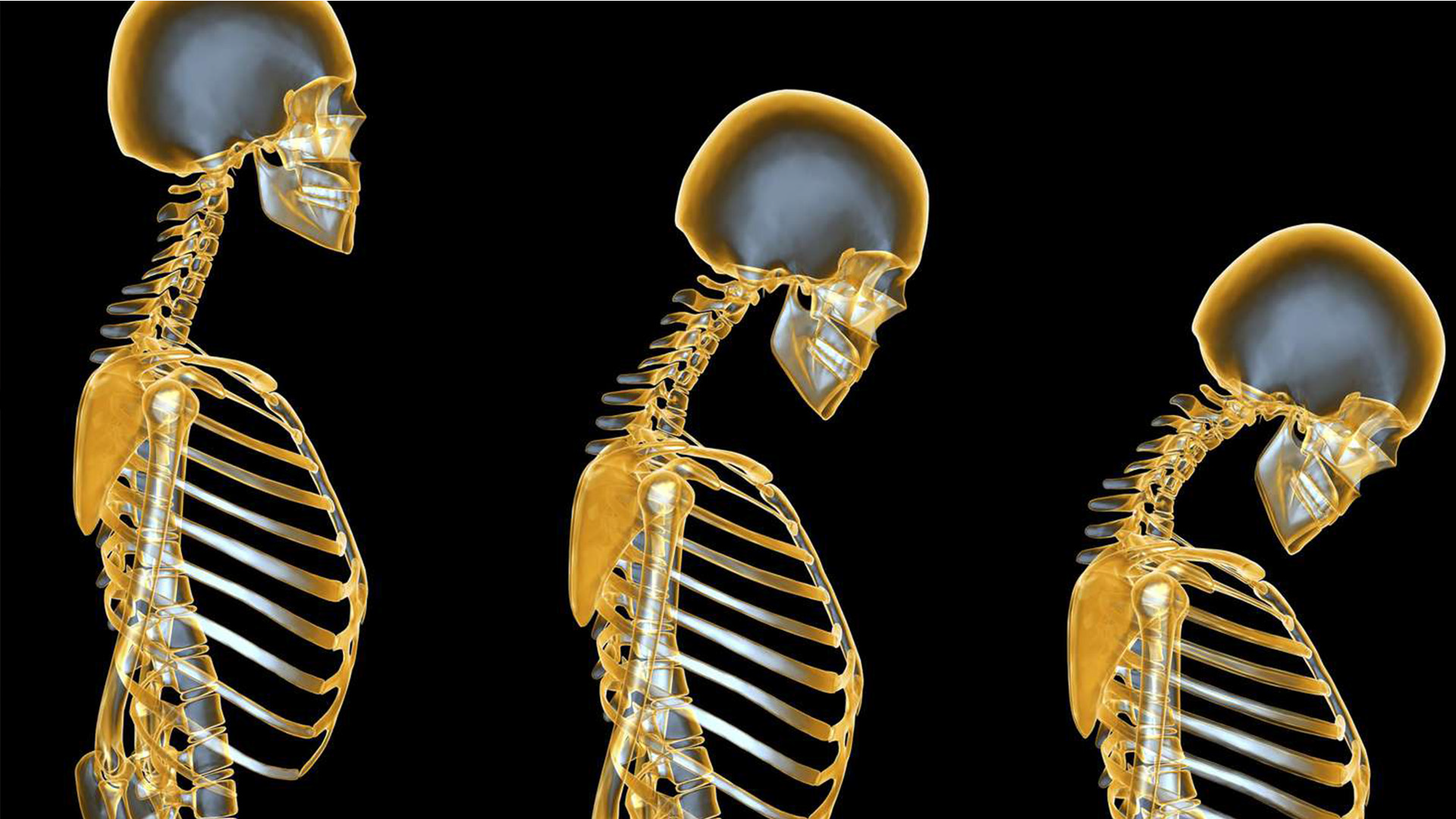 ShortCourseProductPics_-Osteoporosis